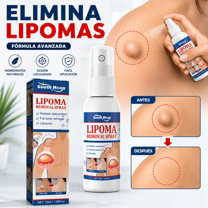 Spray Reductor de Lipomas y Bultos de Grasa X2