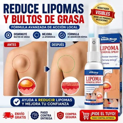 Spray Reductor de Lipomas y Bultos de Grasa X2
